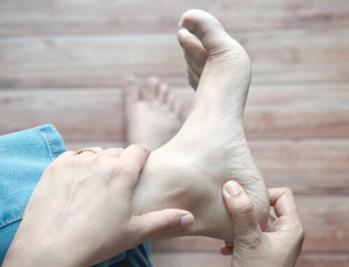 Plantar Fasciitis Treatment